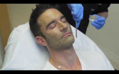 Dr. Emer: Cosmelan Peel Treatment