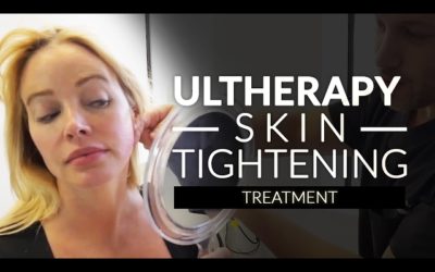 Ultherapy skin tightening