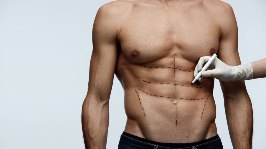 Cosmetic Surgery Procedures For Men