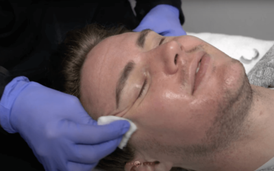 JUSTIN REVEPEEL CHEMICAL PEEL