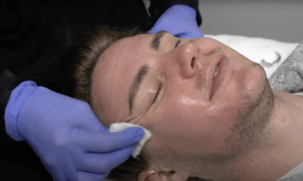 JUSTIN REVEPEEL CHEMICAL PEEL