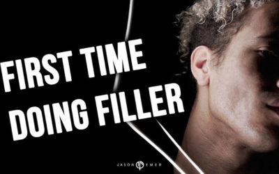 WILL | MALE FACIAL SCULPTING USING FILLER | WEST HOLLYWOOD, CA. | DR. JASON EMER