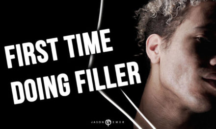 WILL | MALE FACIAL SCULPTING USING FILLER | WEST HOLLYWOOD, CA. | DR. JASON EMER