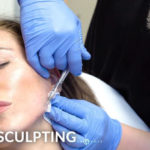 FEMALE FACIAL SCULPTING OF THE JAWLINE AND CHIN WITH FILLERS