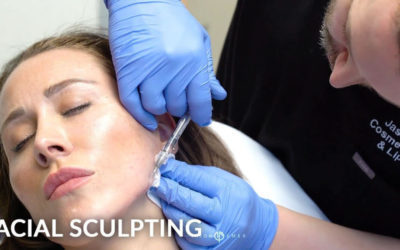 FEMALE FACIAL SCULPTING OF THE JAWLINE AND CHIN WITH FILLERS