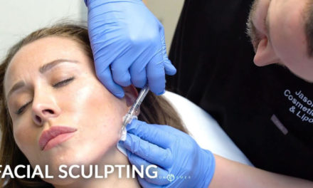 FEMALE FACIAL SCULPTING OF THE JAWLINE AND CHIN WITH FILLERS