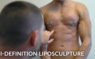 MALE VASER HI-DEFINITION FULL BODY LIPOSUCTION FOR A TIGHT, TONED, AND SCULPTED BODY