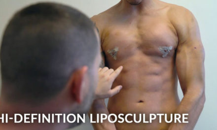 MALE VASER HI-DEFINITION FULL BODY LIPOSUCTION FOR A TIGHT, TONED, AND SCULPTED BODY