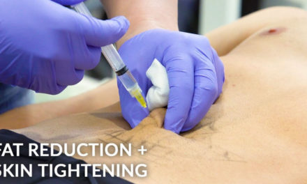 COMBINATION FAT REDUCTION & SKIN TIGHTENING