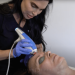 CLEAR AND BRILLIANT WITH MICRONEEDLING AND PRP EXPLAINED