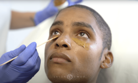 JAMAL – COSMELAN TREATMENT FOR ACNE SCARS & HYPERPIGMENTATION