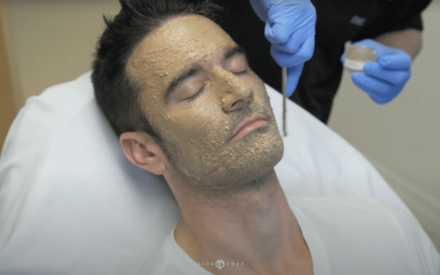 JEFF – COSMELAN PEEL TO TREAT MELASMA