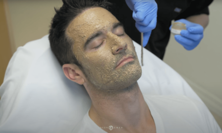 JEFF – COSMELAN PEEL TO TREAT MELASMA