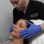 FEMALE FACIAL SCULPTING OF THE CHEEKS, NASOLABIAL FOLDS AND CHIN WITH FILLERS