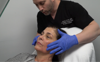 FEMALE FACIAL SCULPTING OF THE CHEEKS, NASOLABIAL FOLDS AND CHIN WITH FILLERS