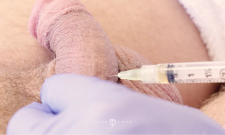 PLATELET-RICH PLASMA (PRP) FOR PENILE REJUVENATION