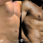 FULL BODY MALE GLADIATOR TRANSFORMATION Before and After Photo by Dr. Emer and Dr. Sanan in West Hollywood California