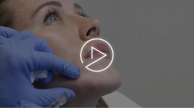 Facial Sculpting Treatment | Facial Sculpting with Revanesse Versa | Jawline Contouring video thumbnail.png