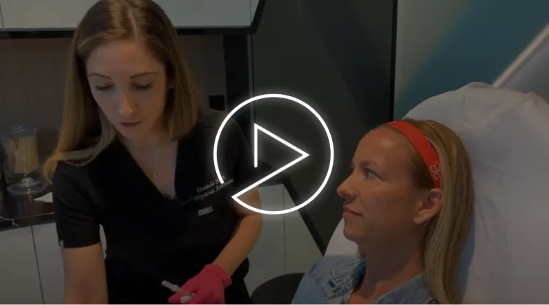 Jeuveau for Forehead Lines | West Hollywood, CA | Dr. Jason Emer