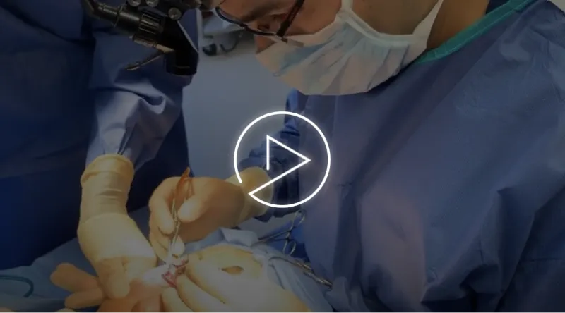 Lower Blepharoplasty | West Hollywood, CA | Dr. Jason Emer video thumbnail